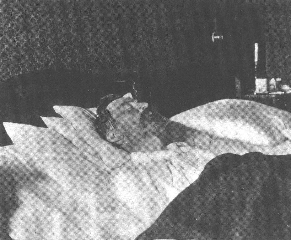 Баденвейлер. А.П. Чехов на смертном одре. Июль 1904 г. Фотография